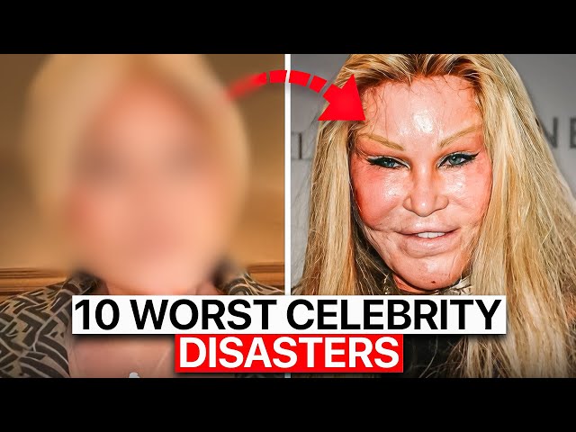 Top 10 Celebrities Who Regret Their Surgery Decisions! (before/after)