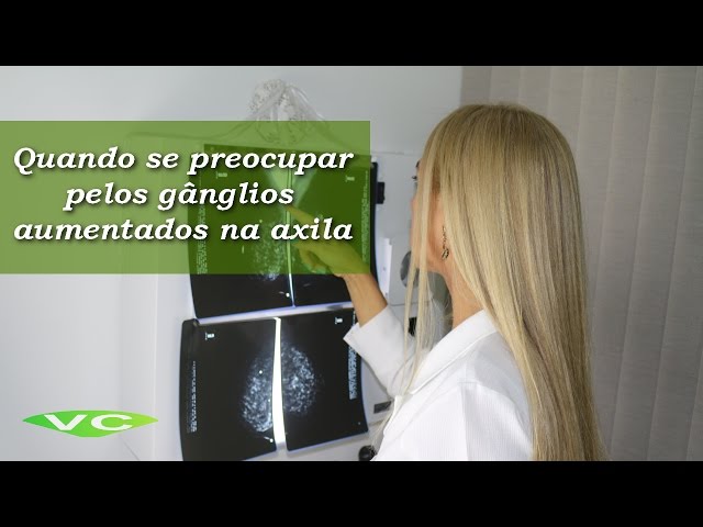 Gânglios na Axila ⚠️ ALERTA! ⚠️ Quando deve  se PREOCUPAR? - Dra. Vanderlea Coelho ®️ Câncer de Mama