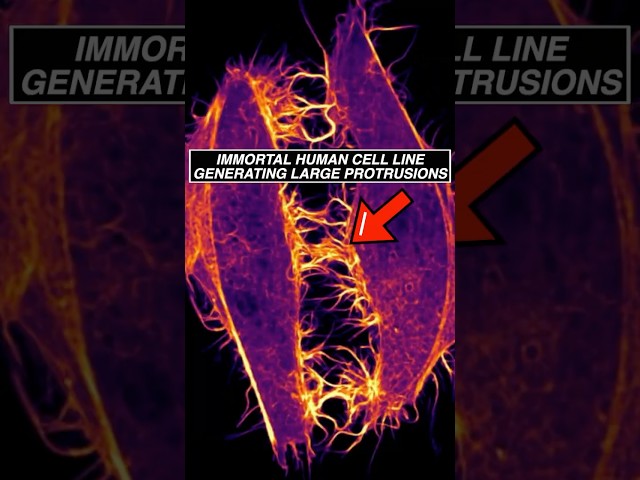 Immortal human cell line (HeLa) generate large dynamic protrusions #cell #biology #microscope