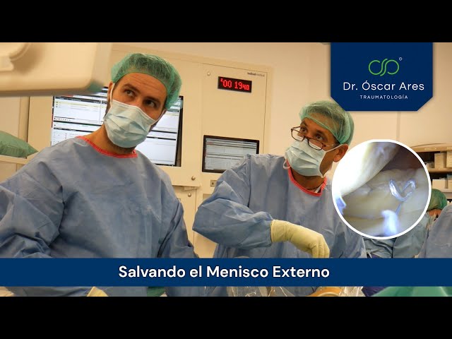 Salvando el Menisco Externo - Dr. Oscar Ares