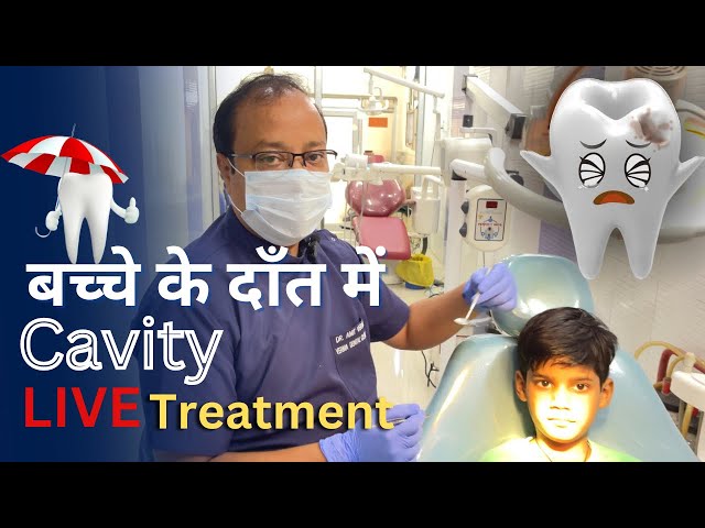 CHILD CAVITY -Treatment | Dr.Amit Verma