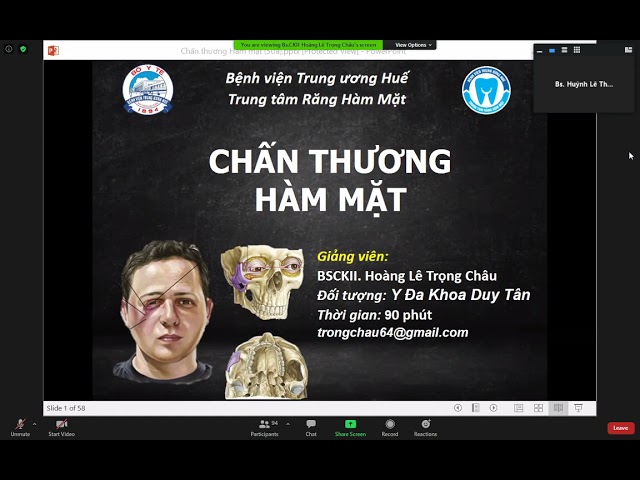 Chấn thương hàm mặt