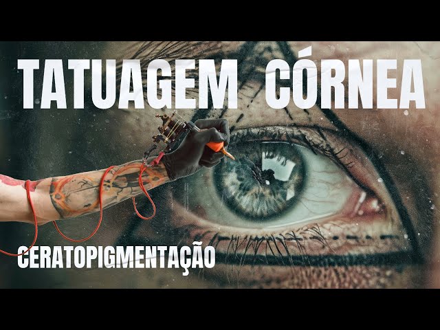 Tatuagem na Córnea: Alternativa Estética ou Risco à Saúde Ocular?