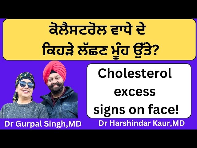 Cholesterol excess signs on face !! ਕੋਲੈਸਟਰੋਲ ਵਾਧੇ ਦੇ ਕਿਹੜੇ ਲੱਛਣ ਮੂੰਹ ਉੱਤੇ ਦਿਸਦੇ ਹਨ!(369)