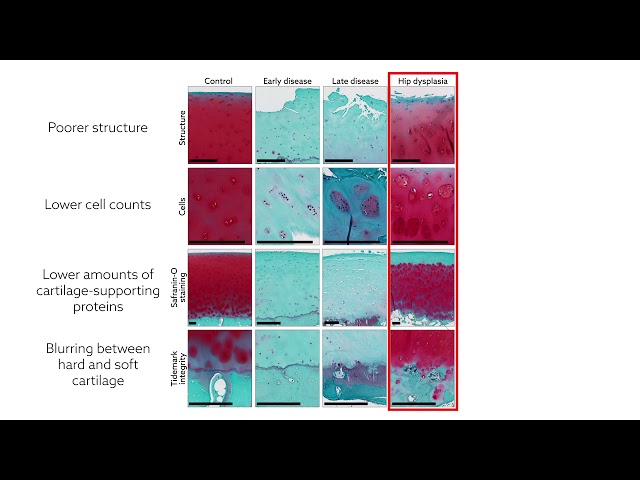 Tracing the inflammatory origins of hip impingement symptoms