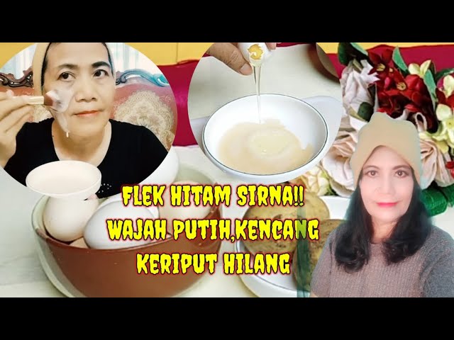 Flek Hitam Lenyap‼️Masker Kentang Untuk Flek Hitam,Jerawat Dan Memutihkan Wajah ~ TheSinta WongJOWO