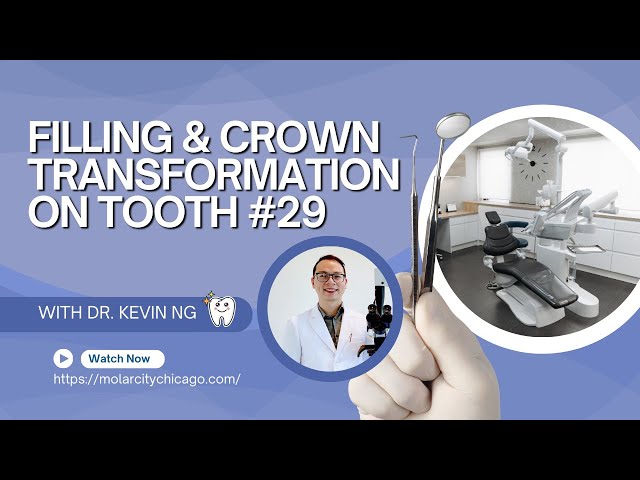 From Decay to Perfect Smile 🦷✨ | Filling & Crown Transformation on Tooth #29