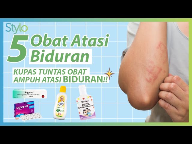 5 Obat Biduran Ampuh & Cara Mengatasi dari Rumah | Harus dengan Resep Dokter! | Stylo.ID