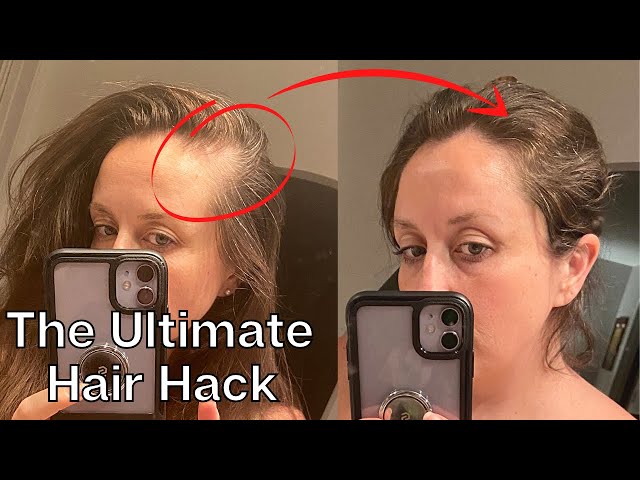 Fix Your Hairline WITHOUT Make Up Or Root Touch Up | M Line | Chahong | KATE KOSLOV