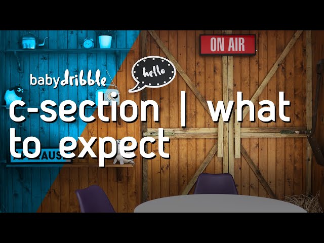 C-Section, what to expect | BABY DRIBBLE: THE PODCAST | Episode: 21