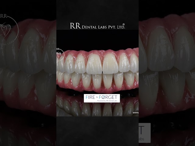 "RR Dental Lab – Excellence in Every Dental Restoration!"