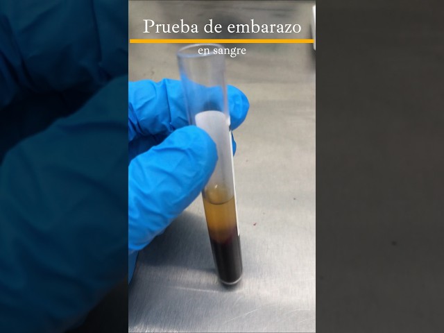 Así se lee una prueba de embarazo en sangre #tutorial #embarazo #embarazada