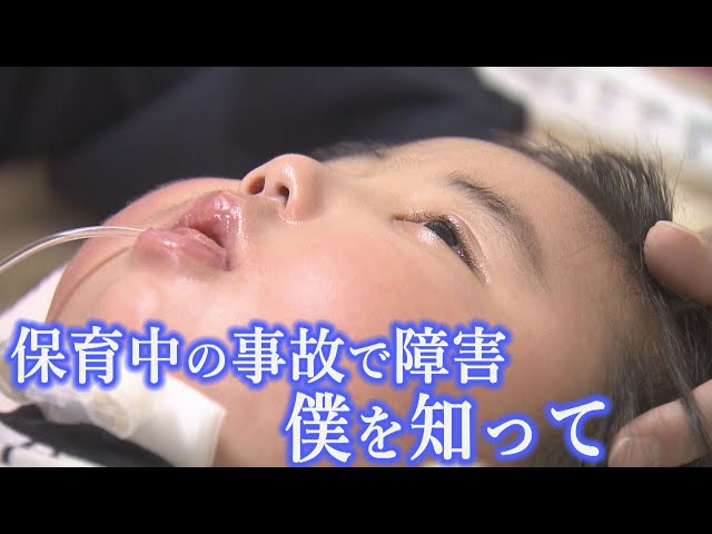 保育中の事故で障害残る男の子　両親が今抱える思い【Jチャンいわて動画】