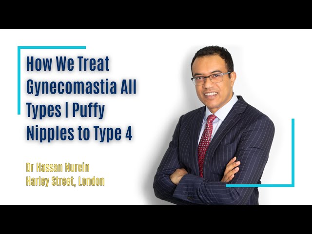 How We Treat Gynecomastia All Types | Puffy Nipples to Type 4 | Dr Hassan Nurein Harley St London