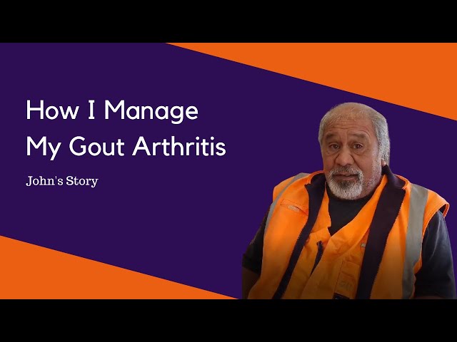 How I Manage My Gout Arthritis - John