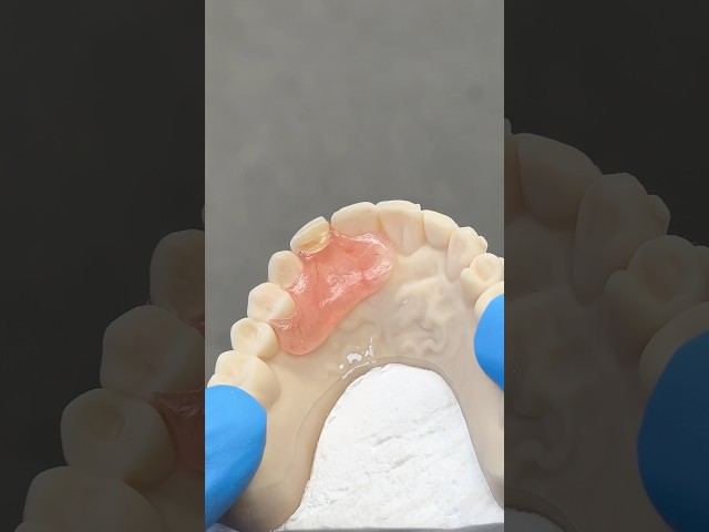 Lateral Nesbit #lsk121shorts #dental #teeth