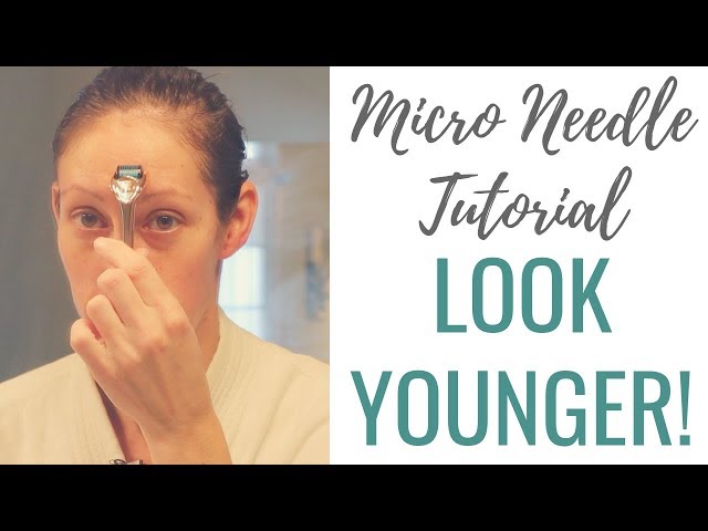 Facial Microneedling Tutorial | DIY Skin Treatment | Collagen Induction Therapy Melasma & Acne Scars