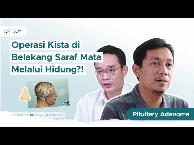 Operasi Kista di Belakang Saraf Mata! | Cerita Tumor Otak #13