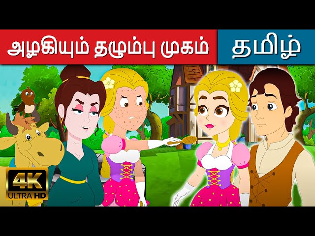 அழகியும் தழும்பு முகம் - Story In Tamil | Kathaigal | Fairy Tales In Tamil |Bedtime Stories In Tamil