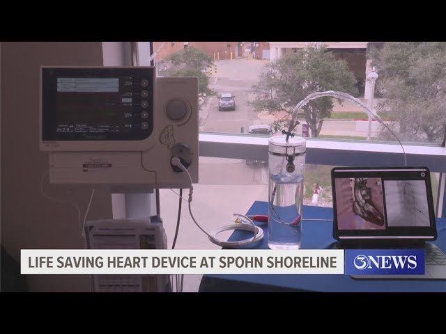 New device in use at Spohn Shoreline helps take load off patients' hearts recover from cardiac episo