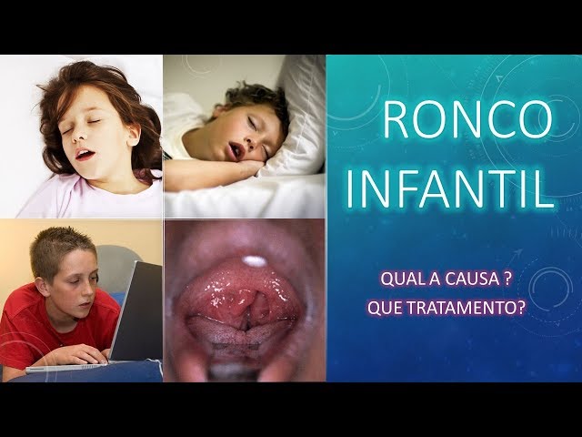 Causas de ronco infantil tratamento - Médico do Sono