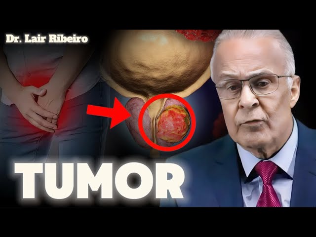 DO NOT PERFORM A RECTAL EXAM WITHOUT WATCHING THIS VIDEO - Dr. Lair Ribeiro