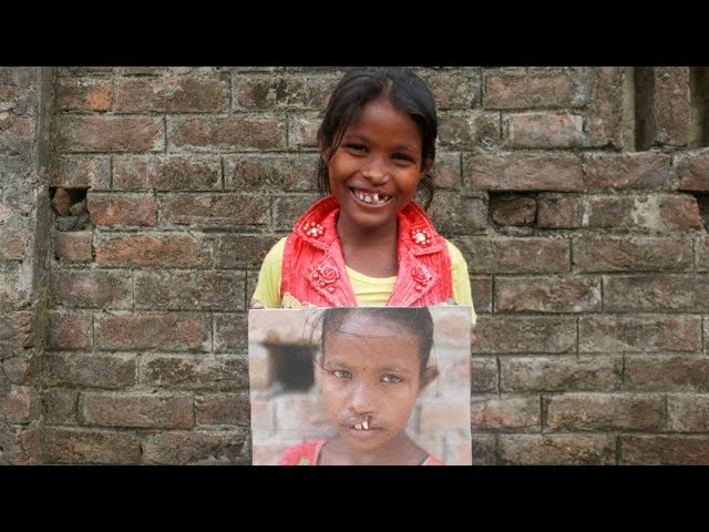 The Story of Nisha | 360° Smiles