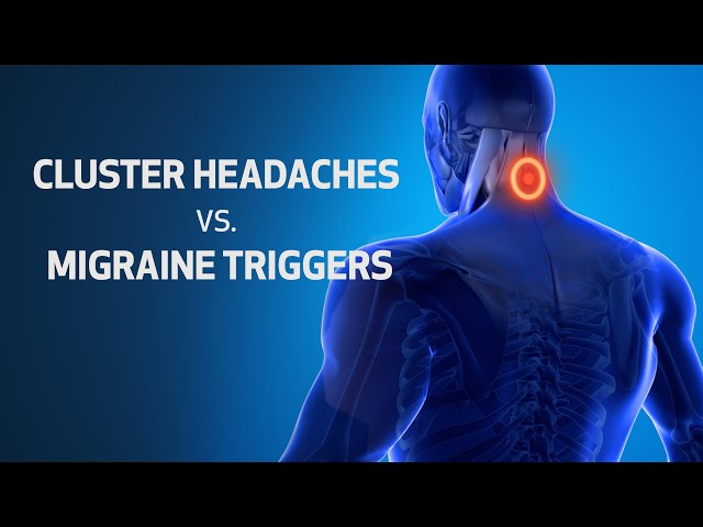 Headache vs Migraine Triggers | Houston Methodist