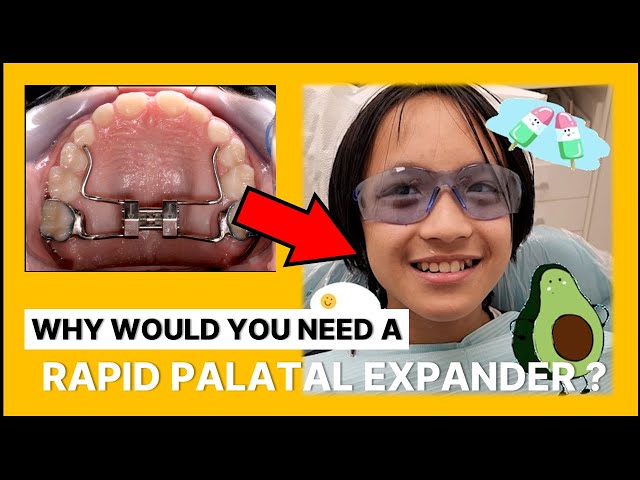 TERRENCE NEEDS AN EXPANDER - The Reason Why You May Need It TOO!