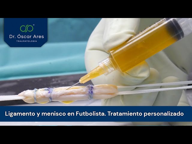 Ligamento y menisco en Futbolista. Tratamiento personalizado - Dr. Óscar Ares