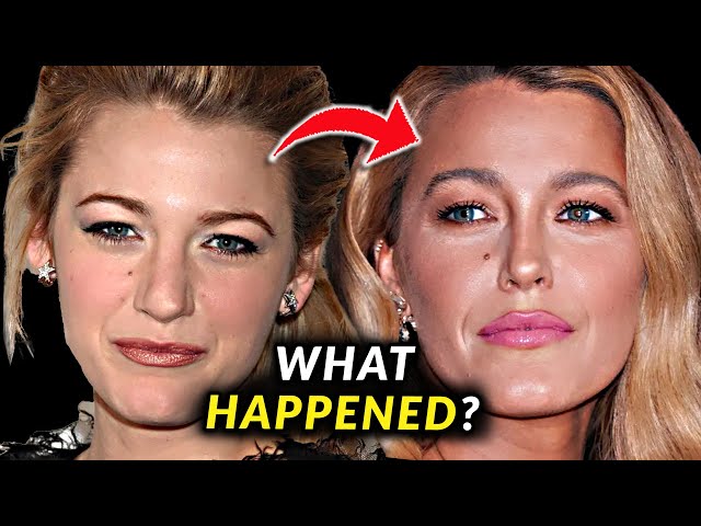 Blake Lively's Face - Before and After