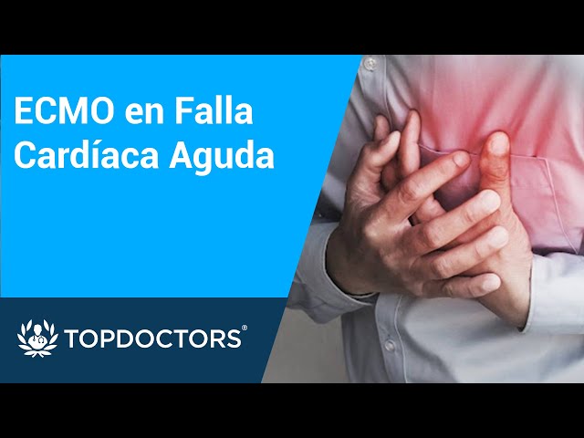 ECMO en Falla Cardíaca Aguda