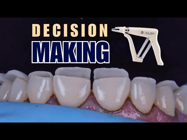 Decision Making for Anterior Composites - PDP211