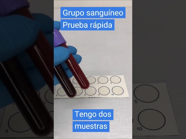 ¿Cómo se hace un grupo sanguíneo? Prueba rápida #laboratorioclinico #hematologia #short