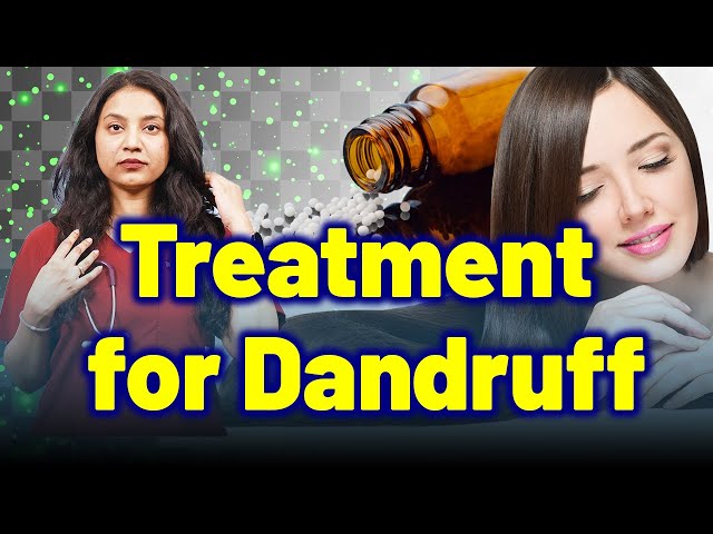 Treatment for Dandruff, Seborrheic Dermatitis, Psoriasis . | Treatment & Cure | Homeopathy, Medicine