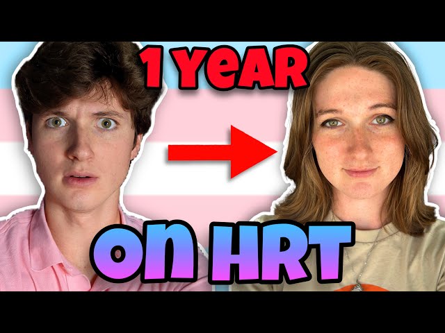 1 Year On HRT | Transgender MTF Timeline