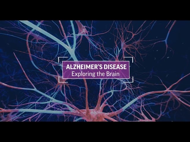 Alzheimer's Disease: Exploring The Brain