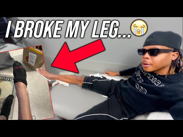 I GOT into a FIGHT and BROKE My Leg... (w/ video footage)