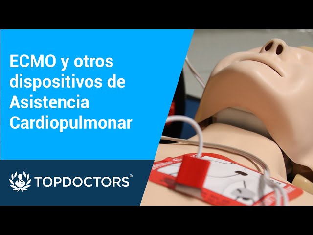 ECMO y otros dispositivos de Asistencia Cardiopulmonar