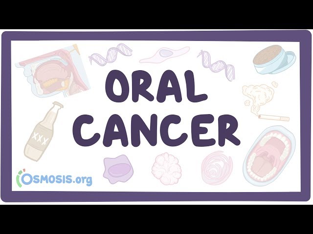 Oral Cancer - causes, symptoms, diagnosis, treatment, pathology