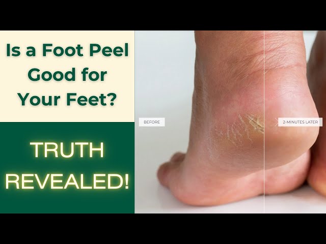 IS A FOOT PEEL GOOD for YOUR FEET? Do They Work on Cracked Heels? #2025reviews #beforeafter #truth