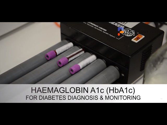 HbA1c - how it can detect glucose in your body for type 2 diabetes