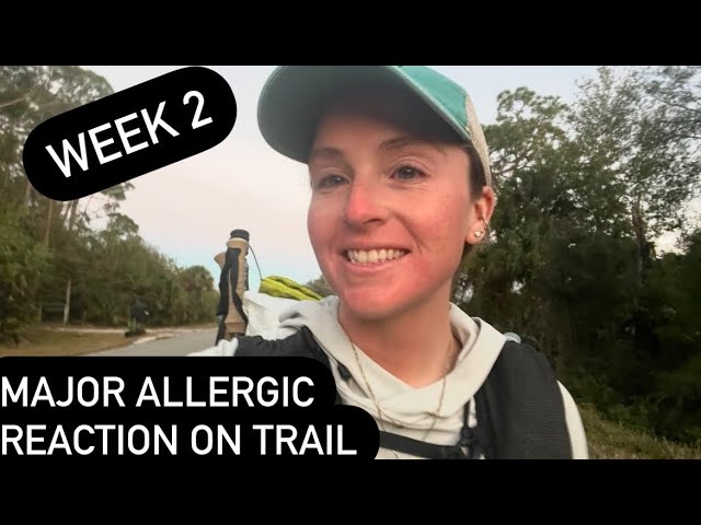 Major Allergic Reaction While on Trail