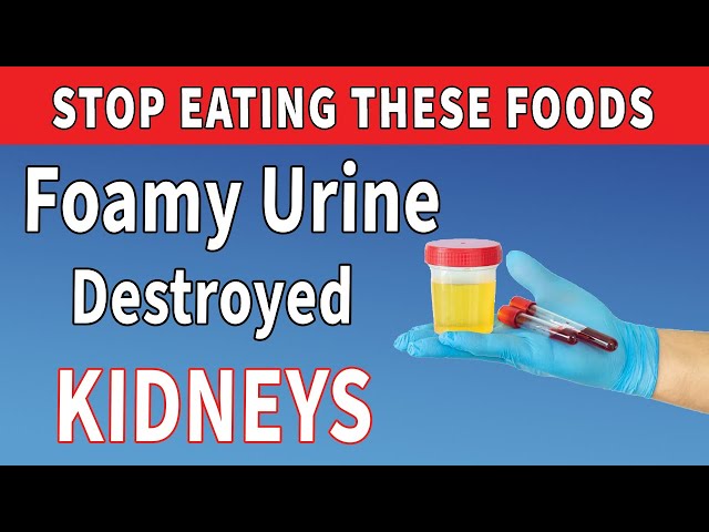 7 Dangerous Foods That Worsen Proteinuria & Harm Your Kidneys – Avoid These Now!