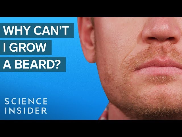 Why Some Men Can't Grow Beards