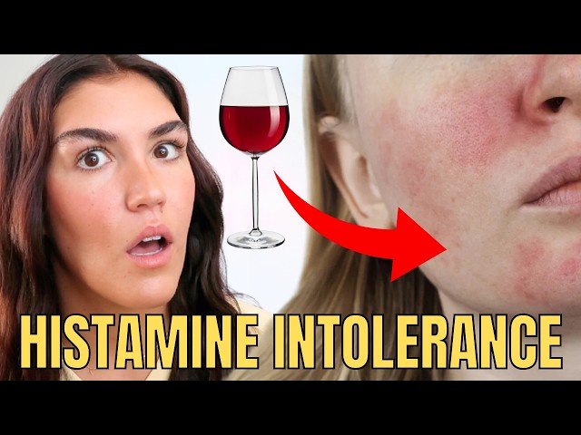 12 Warning Signs of Histamine Intolerance and How to Treat It (Diet and Supplements)