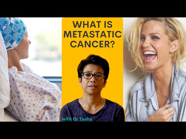 What is Metastatic Breast Cancer? - Dr Tasha explains in this video