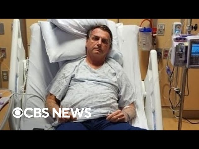 Former Brazilian President Jair Bolsonaro released from Florida hospital