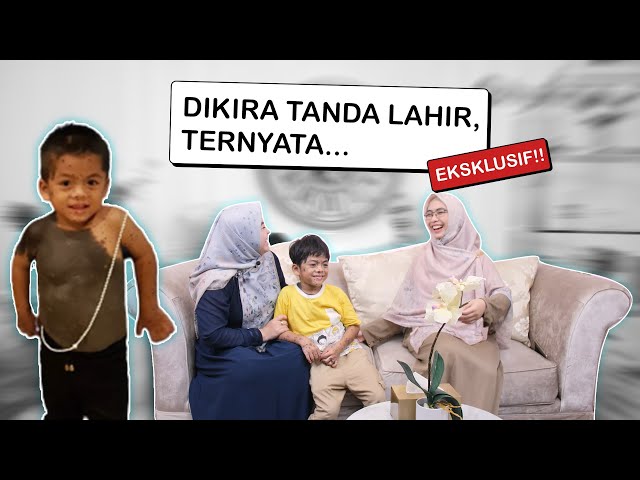 PART 1 (GHAIDAN) | TAHI LALAT DI SELURUH TUBUH… SINDROM NEUROCUTANEOUS #RumahCeritaUmma #PejuangNICU