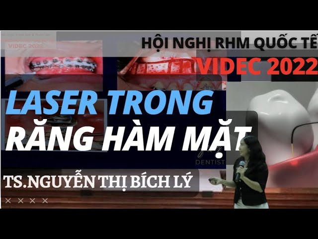 VIDEC 2022 | Sử Dụng Laser Trong Thực Hành Răng Hàm Mặt - TS. Nguyễn Thị Bích Lý